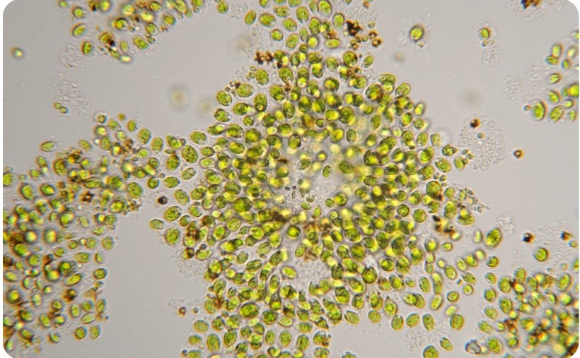 runde grüne Chlorella-Algen, vergrößert